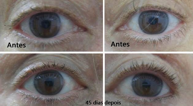 delineador para crescer cilios antes e depois
