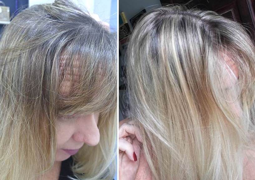 antes e depois retoque raiz